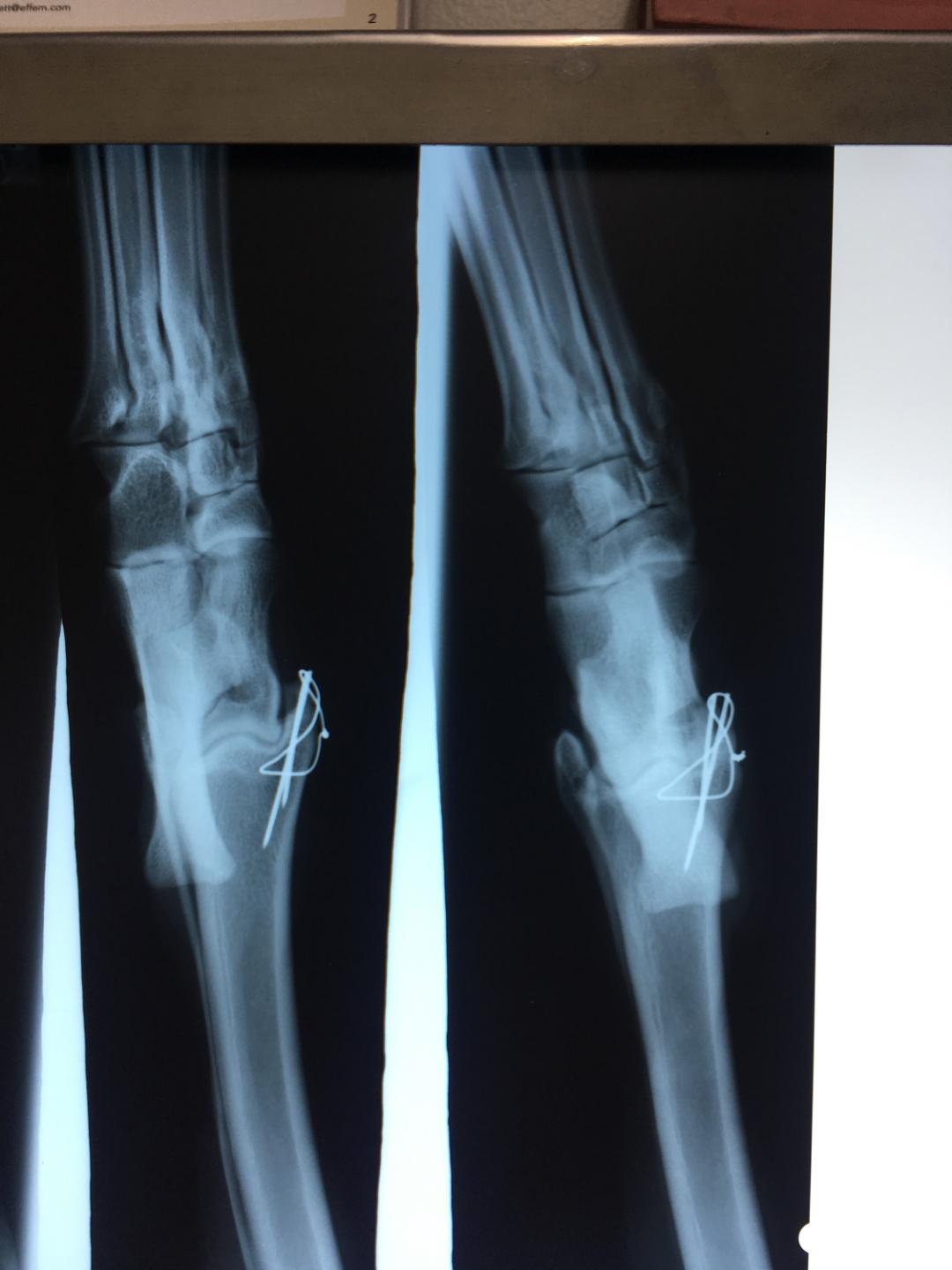 An x-ray of Burnout's injury.